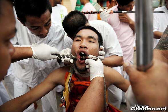 Coutumes etranges : apres ca vous n aurez plus peur d aller chez le dentiste finalement ...