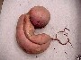 Une patate en forme de foetus