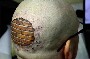 Brick tattoo : un super tatouage en relief a l arriere du crane de ce gars